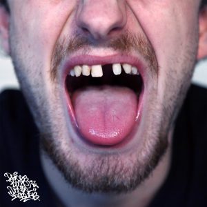 Res & Datkid – Drugs, Booze & Dental Issues – PRE-ORDER NOW